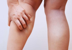 Jambes lourdes : quels nutriments privilégier ?