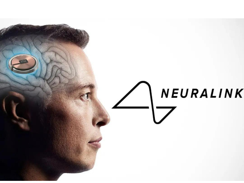 Neuralink obtient le feu vert pour un dispositif révolutionnaire