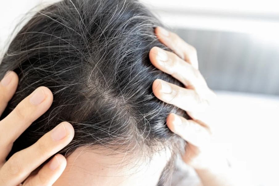 Pourquoi les cheveux blancs apparaissent-ils plus tôt chez les jeunes ?