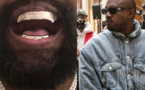 Kanye West dévoile ses nouvelles dents en titane