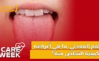 Care Week : الفم المعدني، ما هي أعراضه وكيفية التخلص منه؟