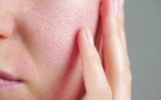 Essayez ces deux soins maison efficaces contre les pores dilatés