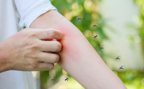 Pourquoi les piqûres de moustiques démangent-elles tant ?
